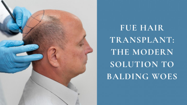 FUE Hair Transplant: The Modern Solution to Balding Woes