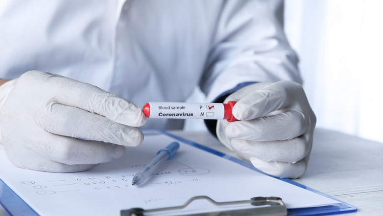 Common Symptoms That Lead to TB testing