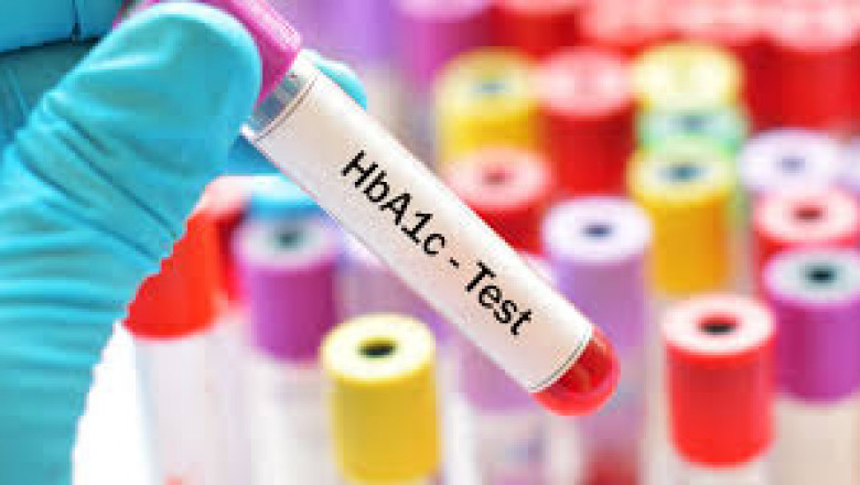 Point-of-Care vs. Laboratory-Based HbA1c Testing: Market Developments 2024–2032